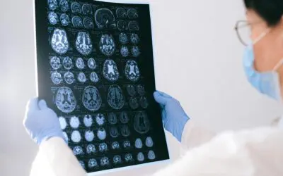 A doctor examines a brain scan.