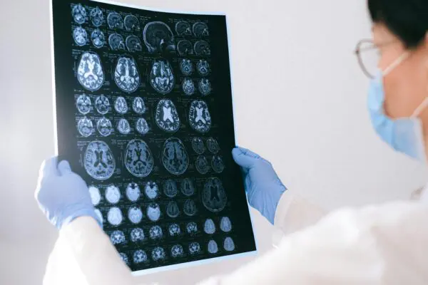 Alzheimer’s Disease: Hope On The Horizon A doctor examines a brain scan.