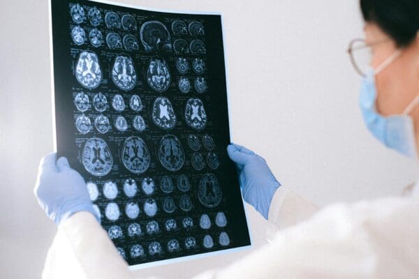 A doctor examines a brain scan.